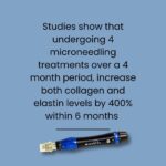 Microneedling